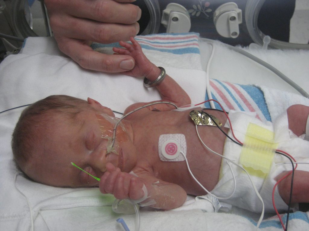 7-pound premature baby